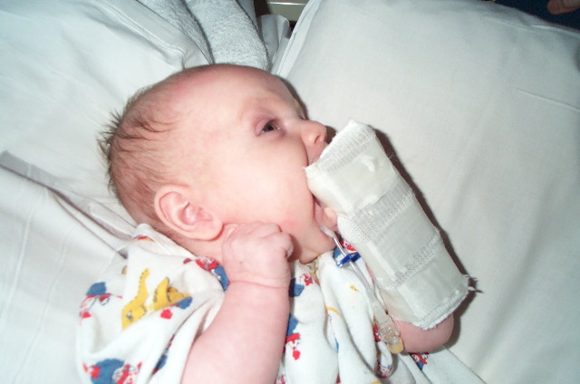Trying to chew the IV